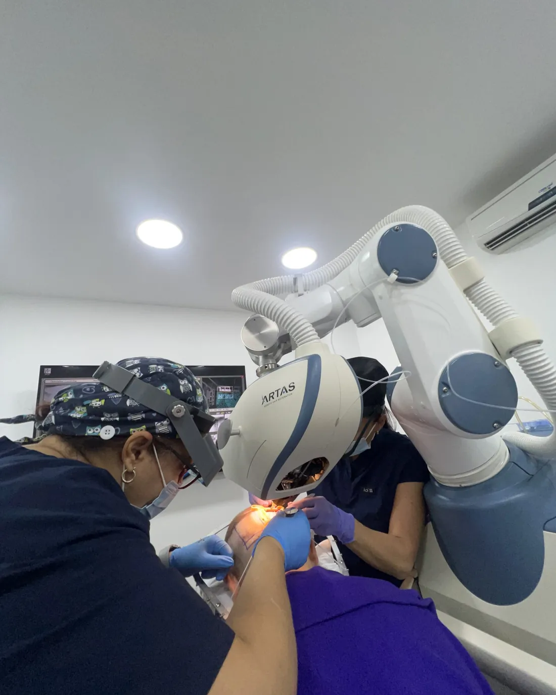 Equipo médico de La Clínica del Pelo con el robot ARTAS
