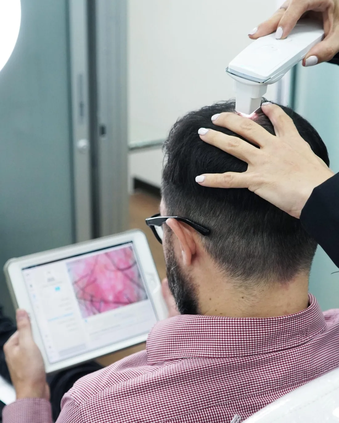 Valoración con SmartHair en La Clínica del Pelo